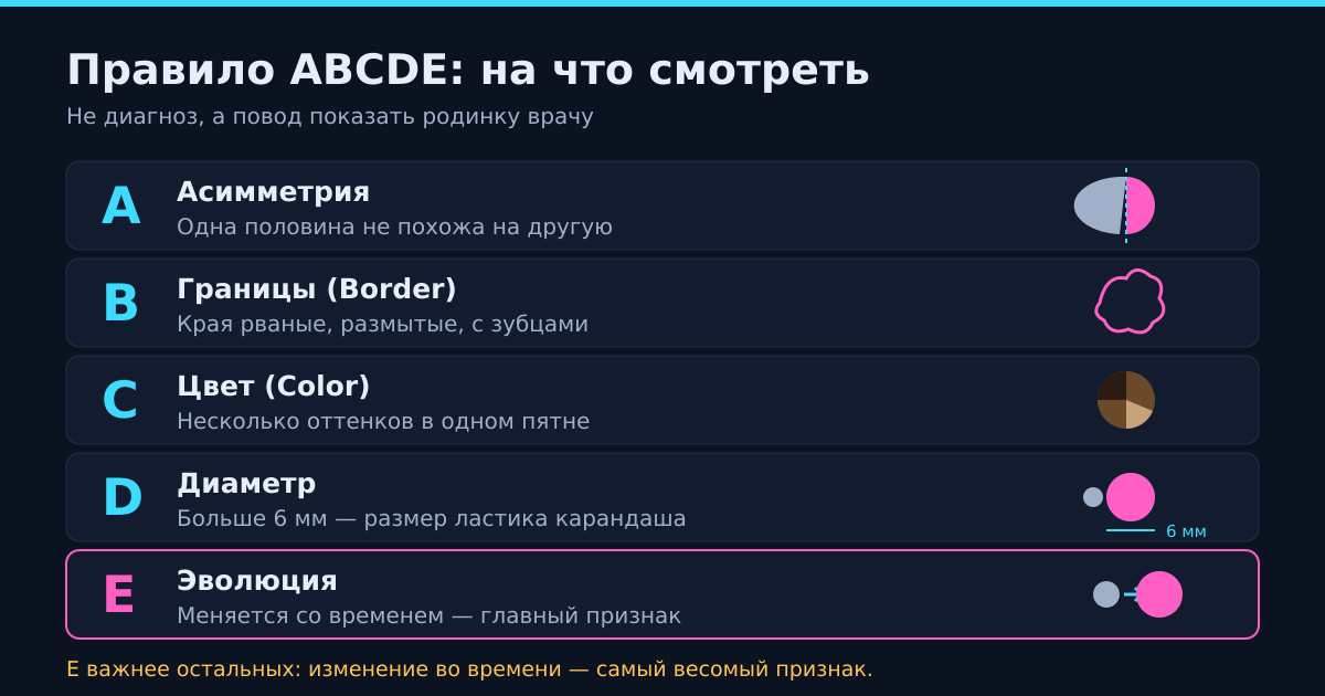 Правило ABCDE: что означает каждая буква и на что смотреть