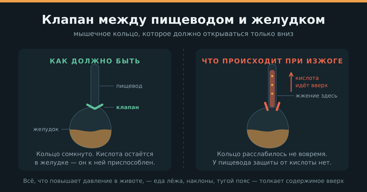 Клапан между пищеводом и желудком: как должно быть и что происходит при изжоге